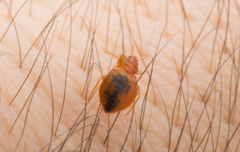 Bed bug crawling on someone's hair and skin.