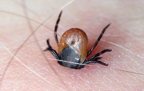 Tick biting through human skin.
